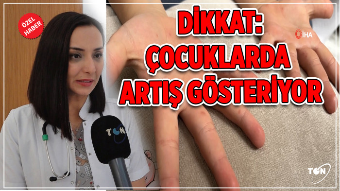  Dikkat: Çocuklarda artış gösteriyor